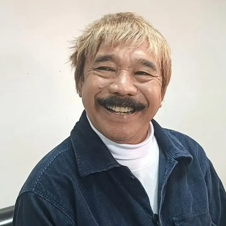 Opie Kumis Ungkap Keinginan Tanam Rambut, Tapi Terhalang Ketakutan Prosedur Medis