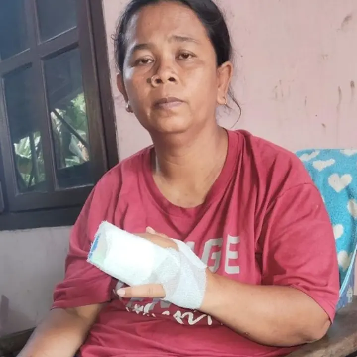 Debt Collector Patahkan Jari Istri Nasabah di Gresik Akibat Utang Suami Rp 1 Juta