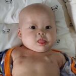 Kisah Chiara: Bayi 8 Bulan Berjuang Melawan Tumor Ganas dan Kelainan Bawaan