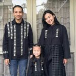 Istri Fiersa Besari Ditabrak Mobil di Stasiun Gambir, Kaki Alami Trauma Otot