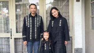 Istri Fiersa Besari Ditabrak Mobil di Stasiun Gambir, Kaki Alami Trauma Otot