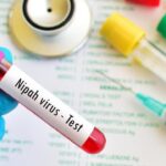 Kemenkes Tegaskan Nihil Kasus Nipah di RI, Pengawasan Ketat Diberlakukan