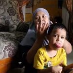 Febio, Bocah 6 Tahun Berjuang Melawan Tumor Lidah Sejak Lahir