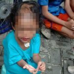 Pilu Nasib Balita Dianiaya dan Dibotaki Paman-Bibi di Surabaya