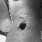 Bayi di Makassar Diduga Malpraktik, Tangan Berlubang Usai Diinfus, RS Buka Suara